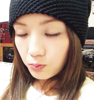 ��sa�Գƻ��ϡ��żٺ�ʧ��֢����Ҫ�ٷż٣�ͼ��