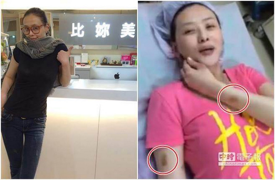 ̨��Ů��������ɹ������Ƶ�ֱ������ࣨͼ��