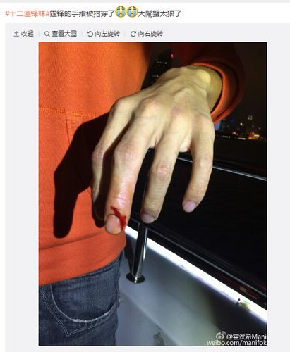 л�����³��ֱ���բзǯ�����ѣ�������ֻз��ͼ��