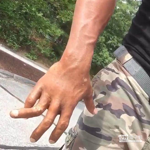 巨石强森手指骨折90度?工作人员:特效化妆(图)