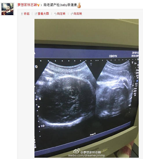 昨日,他又晒出陪妻子产检时的b超照片,还透露胎儿很健康