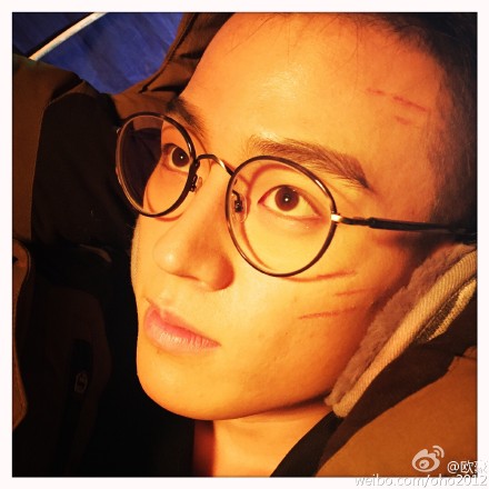 ŷ�����۾��Գơ��Ļ��������������˺ۣ�ͼ��